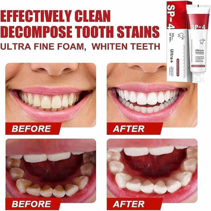 Yayashi SP-4 Ultra Whitening Toothpaste | Stain Remover | Fresh Breath